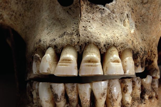 Зубы датского викинга, 972-1025 н. э